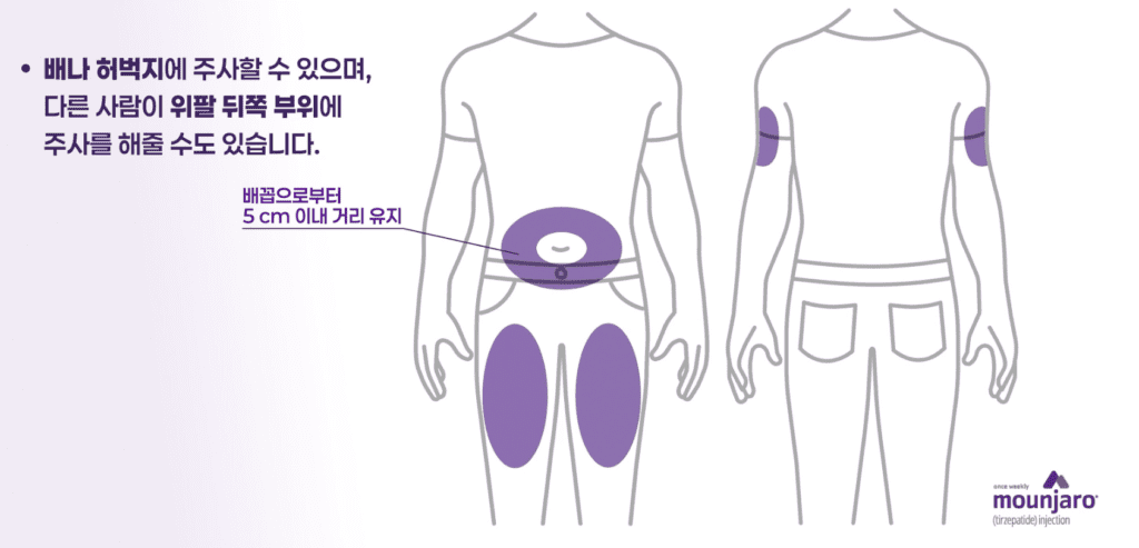 마운자로 올바른 주사 부위인 복부와 허벅지 및 위팔 위치