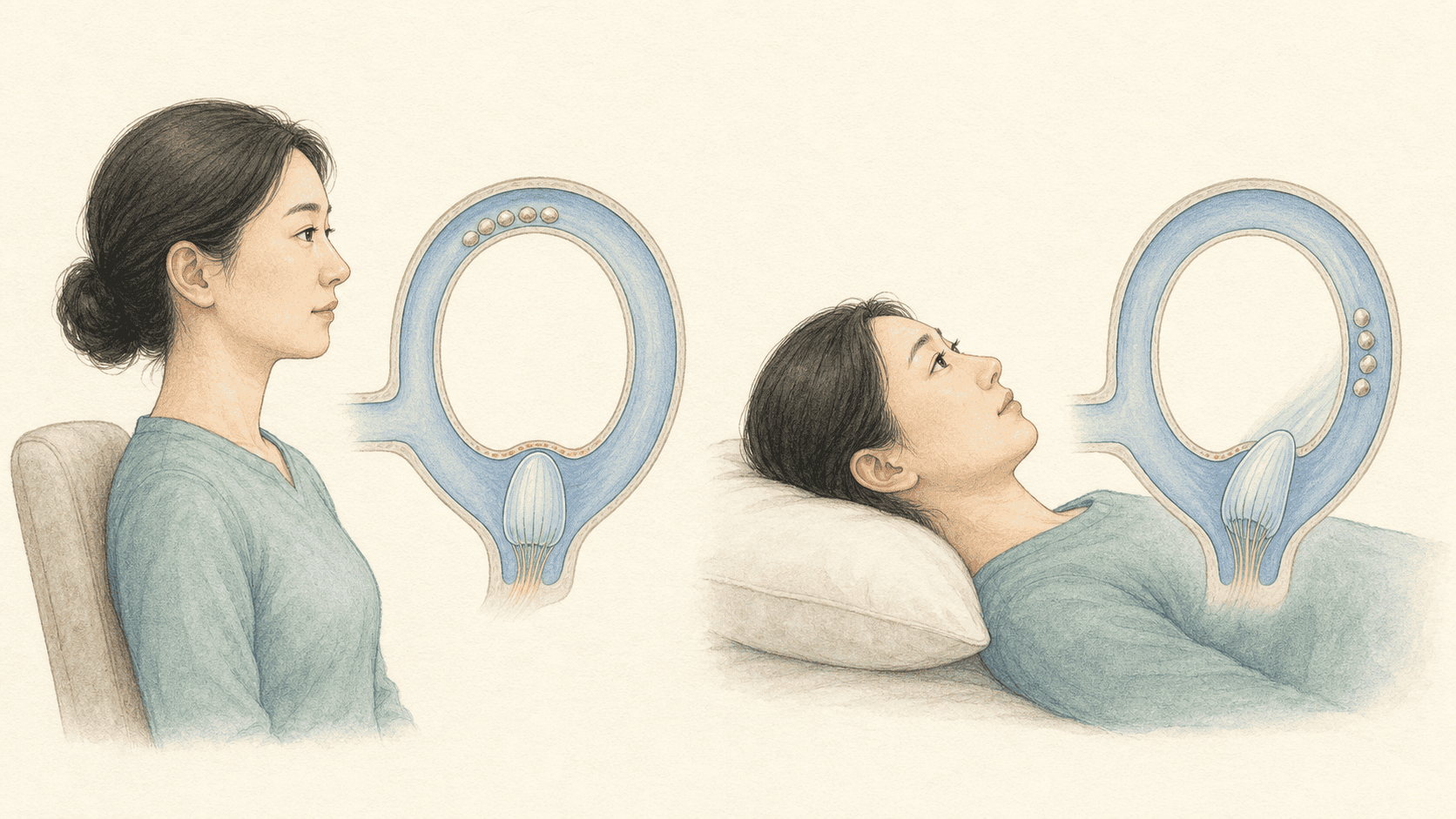 서로 다른 두 머리 자세에서 반고리관 안 이석과 내림프의 위치가 달라진 모습