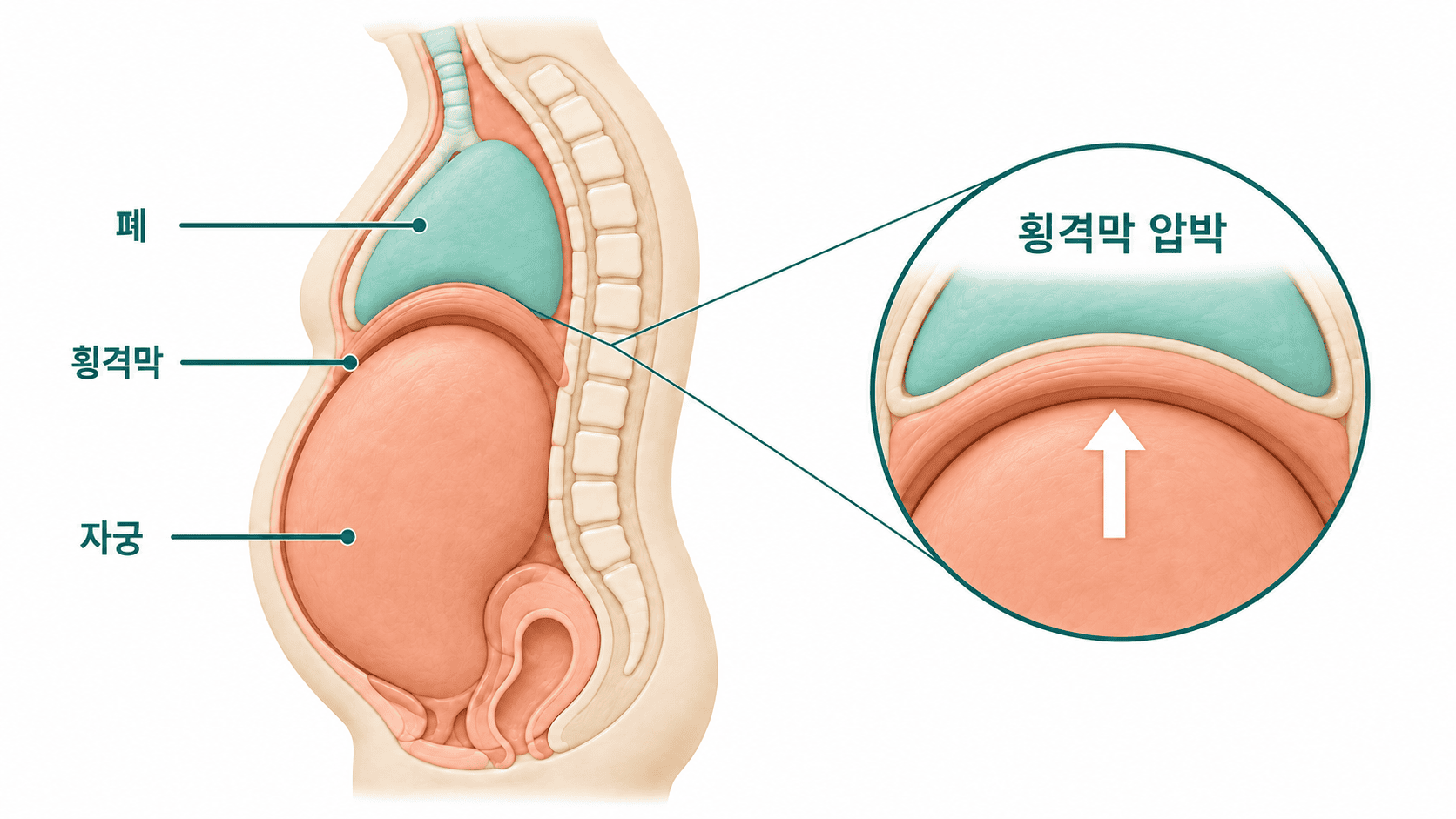 팽창한 자궁이 횡격막을 압박해 폐가 눌리는 여성의 내부 장기.